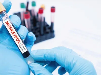 Salud Pública confirma casos de mpox en destacamento de San Cristóbal