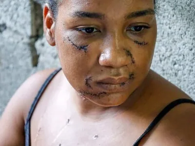 Joven madre sobrevive a 26 estocadas propinadas por su expareja