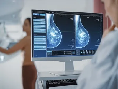 Salud Pública reporta siete nuevos casos de cáncer de mama diarios